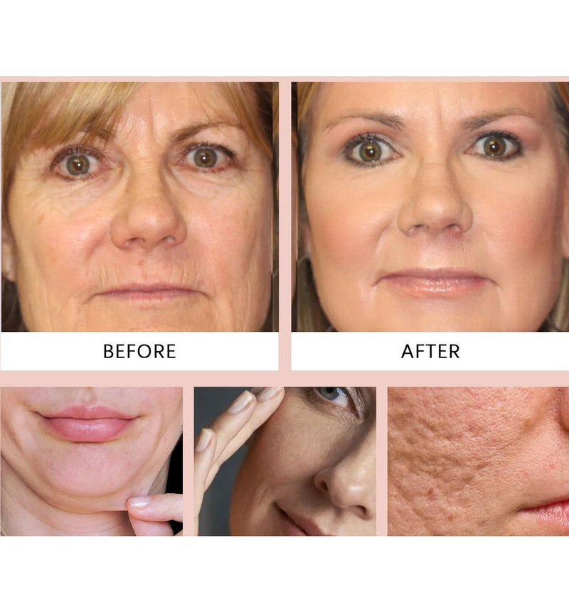 Hoygi™ Mascarilla Facial de Colageno + Aplicador Gratis - [PROMOCIÓN DISPONIBLE SOLO HOY]