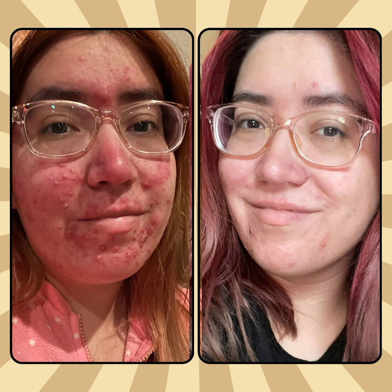 🐂✨EVIL GOODS™ - Nutrición profunda Belleza salvaje